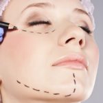 Cosmetic botox injection in the female face.