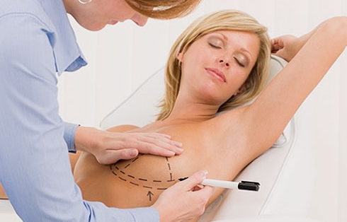 breast augmentation birmingham