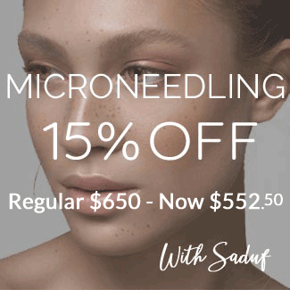 microneedling discount