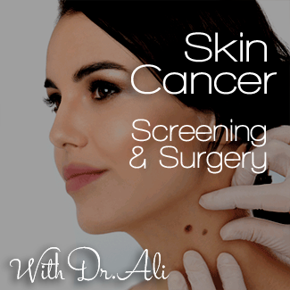 skin cancer screening birmingham
