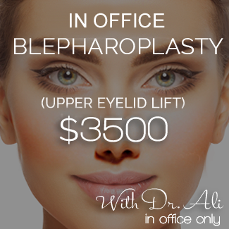 blepharoplasty-eyelid-lift