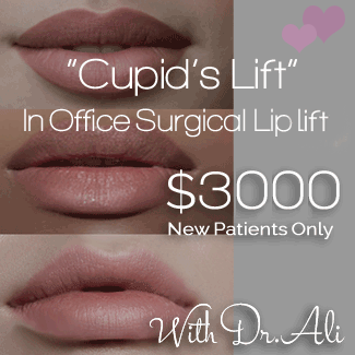 cupid lift special troy, mi