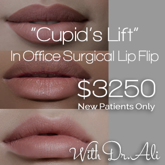 Troy, MI Med Spa Specials