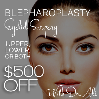 blepharoplasty special birmingham, mi